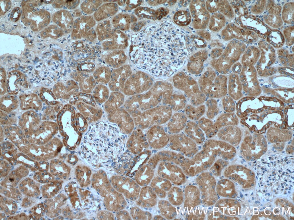 Immunohistochemistry (IHC) staining of human kidney tissue using RNF135 Polyclonal antibody (25061-1-AP)