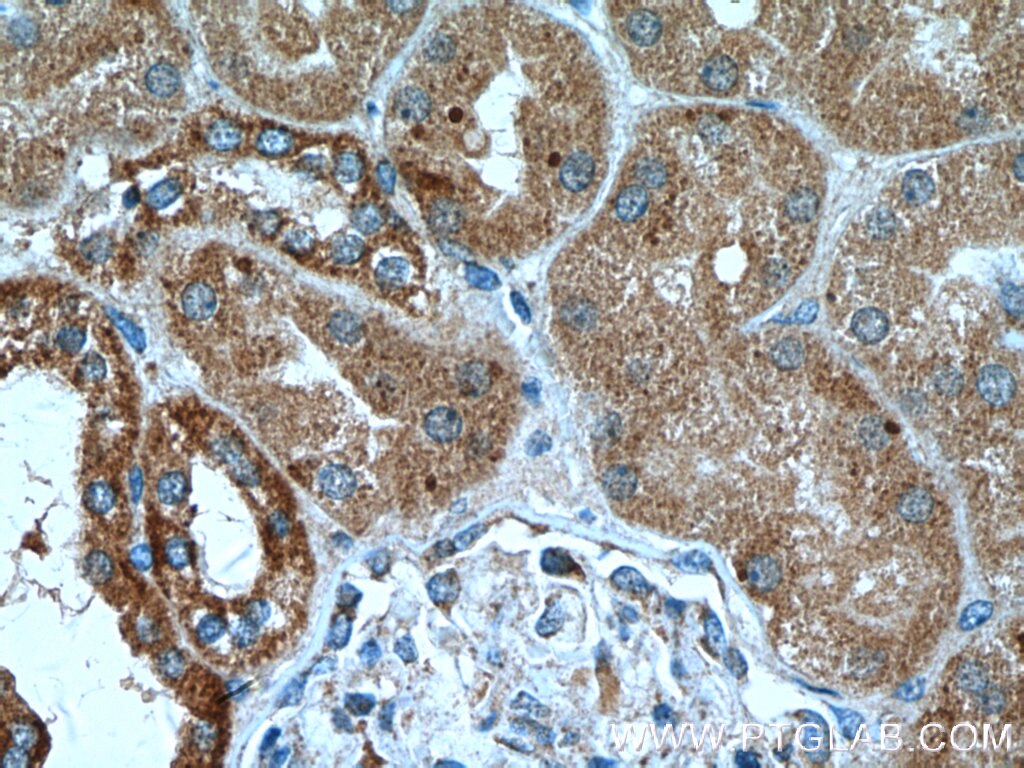 Immunohistochemistry (IHC) staining of human kidney tissue using RNF135 Polyclonal antibody (25061-1-AP)