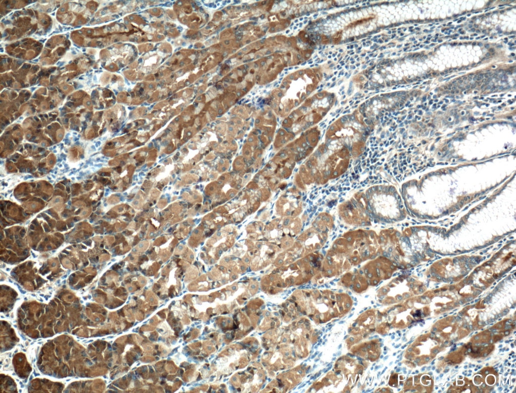 Immunohistochemistry (IHC) staining of human stomach tissue using RNF135 Polyclonal antibody (25061-1-AP)