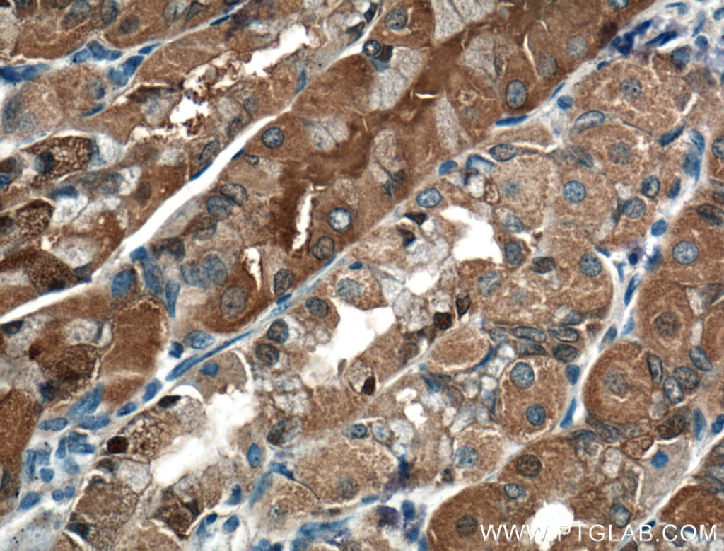 Immunohistochemistry (IHC) staining of human stomach tissue using RNF135 Polyclonal antibody (25061-1-AP)