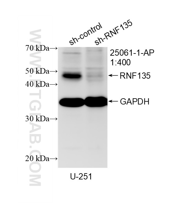 WB result of RNF135 antibody (25061-1-AP; 1:400; incubated at room temperature for 1.5 hours) with sh-Control and sh-RNF135 transfected U-251 cells. Western Blot (WB) analysis of U-251 cells using RNF135 Polyclonal antibody (25061-1-AP)
