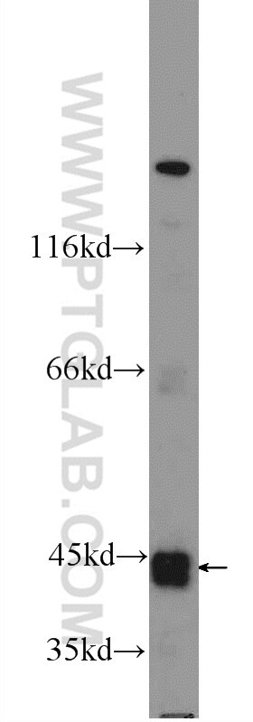 Western Blot (WB) analysis of mouse kidney tissue using RNF135 Polyclonal antibody (25061-1-AP)