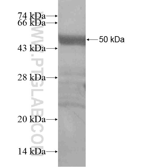 RNF135 fusion protein Ag18816 SDS-PAGE
