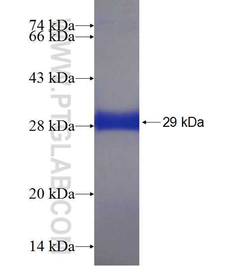 RNF135 fusion protein Ag18821 SDS-PAGE
