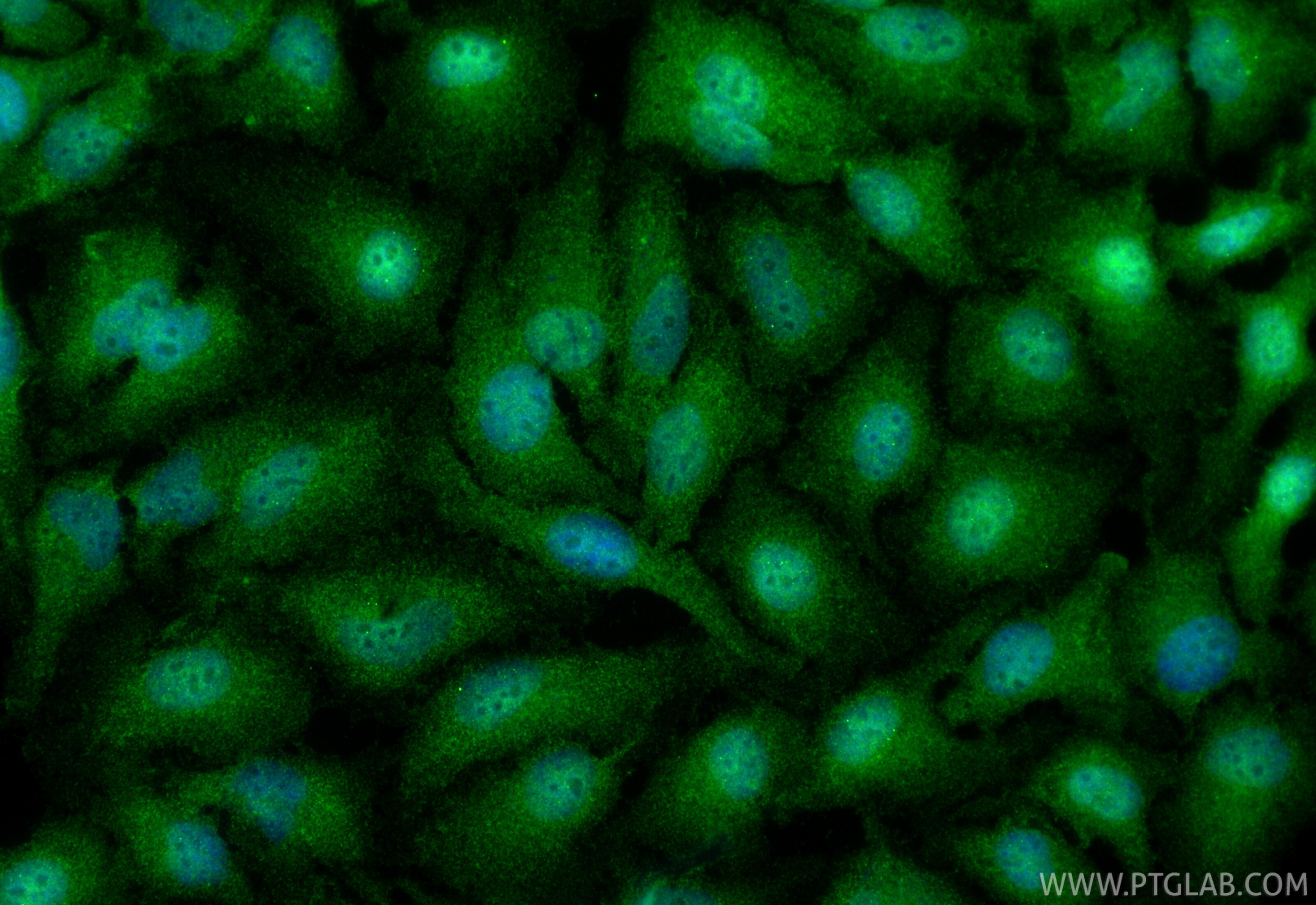 IF Staining of HeLa using 17039-1-AP Immunofluorescence (IF) / fluorescent staining of HeLa cells using RNF138 Polyclonal antibody (17039-1-AP)