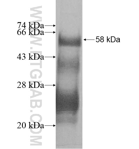RNF138 fusion protein Ag10558 SDS-PAGE