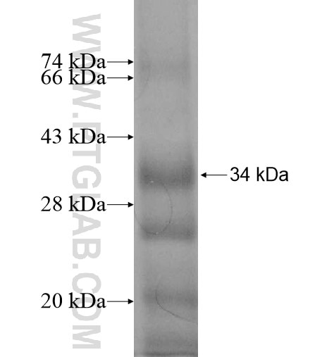RNF138 fusion protein Ag10648 SDS-PAGE