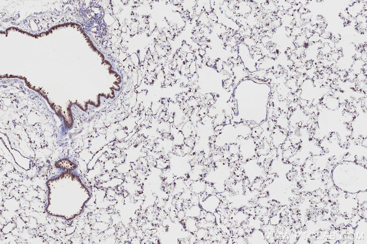 Immunohistochemistry (IHC) staining of rat lung tissue using RNF139 Polyclonal antibody (28261-1-AP)