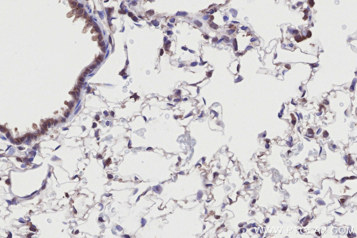 Immunohistochemistry (IHC) staining of rat lung tissue using RNF139 Polyclonal antibody (28261-1-AP)