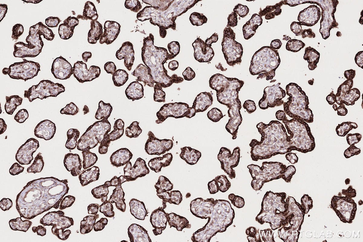 IHC staining of human placenta using 83755-2-RR Immunohistochemistry (IHC) staining of human placenta tissue using RNF139 Recombinant monoclonal antibody (83755-2-RR)