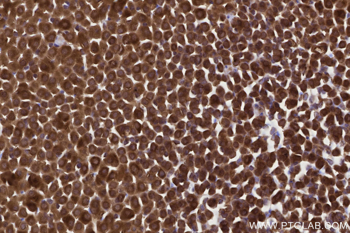 IHC staining of mouse adrenal gland using 83755-2-RR Immunohistochemistry (IHC) staining of mouse adrenal gland tissue using RNF139 Recombinant monoclonal antibody (83755-2-RR)