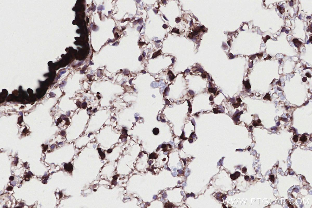 IHC staining of mouse lung using 83755-2-RR Immunohistochemistry (IHC) staining of mouse lung tissue using RNF139 Recombinant monoclonal antibody (83755-2-RR)
