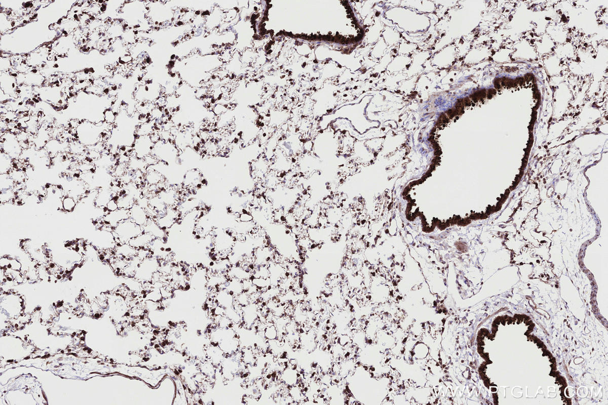 IHC staining of rat lung using 83755-2-RR Immunohistochemistry (IHC) staining of rat lung tissue using RNF139 Recombinant monoclonal antibody (83755-2-RR)