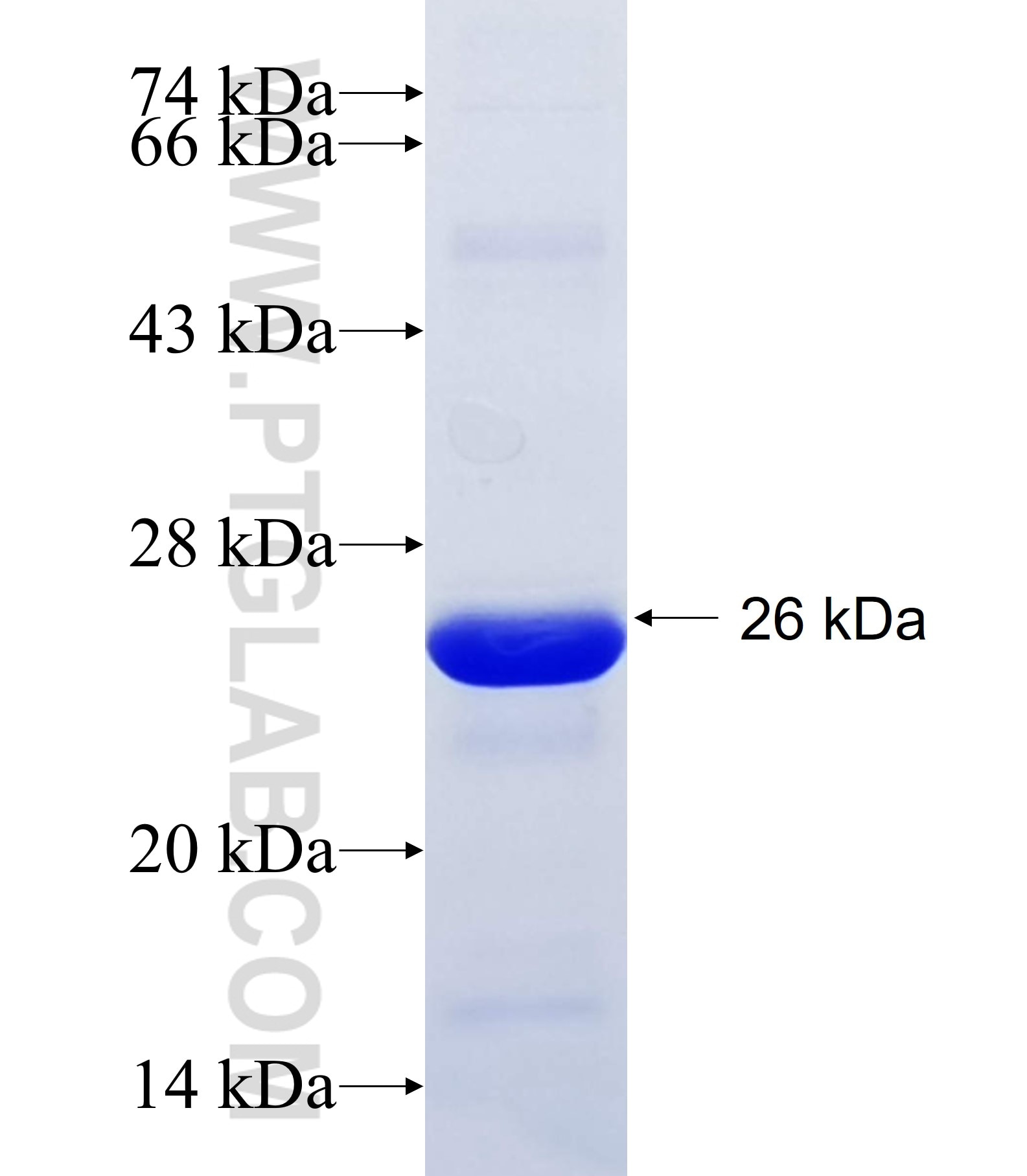 RNF139 fusion protein Ag34744 SDS-PAGE RNF139 fusion protein Ag34744 SDS-PAGE