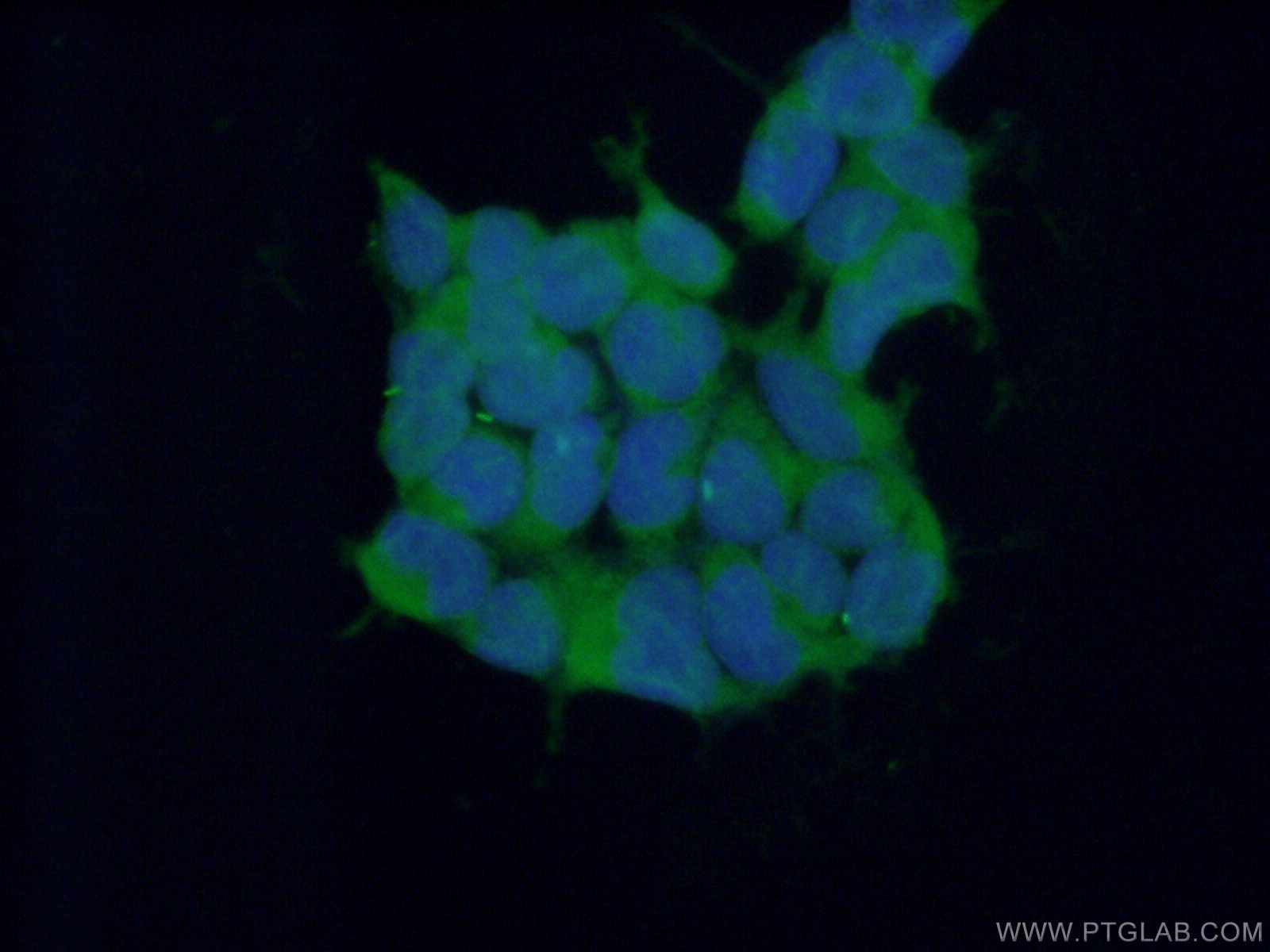 Immunofluorescence (IF) / fluorescent staining of HEK-293 cells using RNF14 Polyclonal antibody (26368-1-AP)