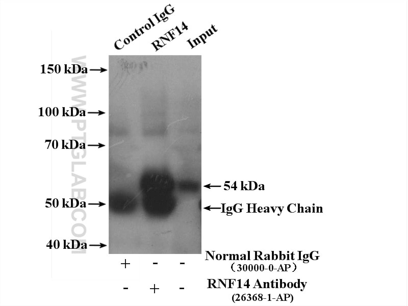 Immunoprecipitation (IP) experiment of COLO 320 cells using RNF14 Polyclonal antibody (26368-1-AP)