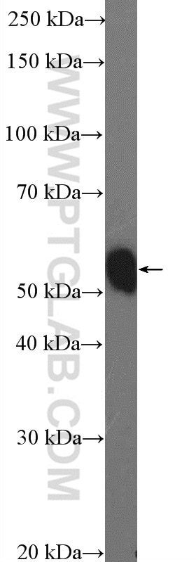 Western Blot (WB) analysis of COLO 320 cells using RNF14 Polyclonal antibody (26368-1-AP)