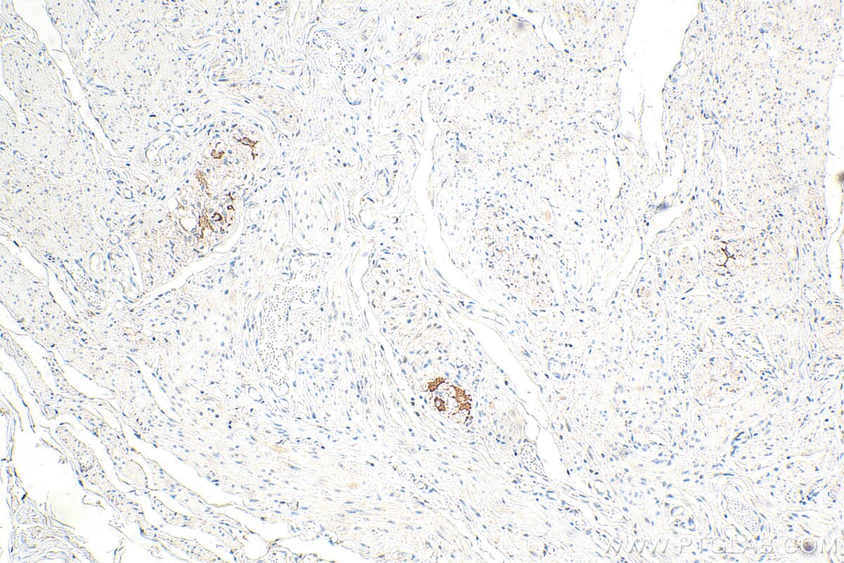 Immunohistochemistry (IHC) staining of human colon tissue using RNF141 Polyclonal antibody (26041-1-AP)