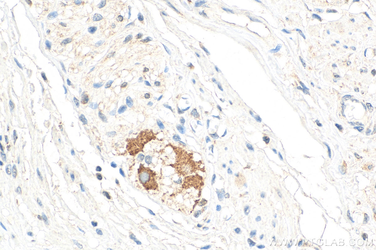 Immunohistochemistry (IHC) staining of human colon tissue using RNF141 Polyclonal antibody (26041-1-AP)