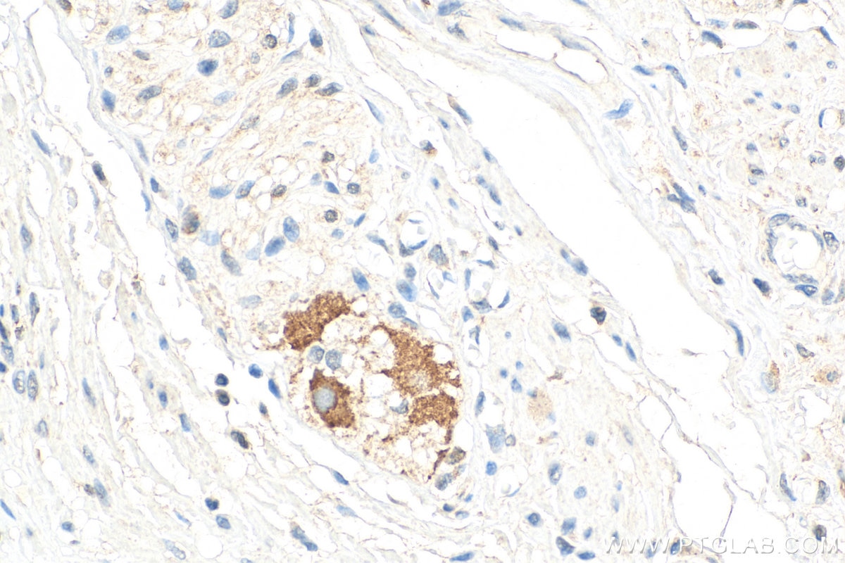 IHC staining of human colon using 26041-1-AP