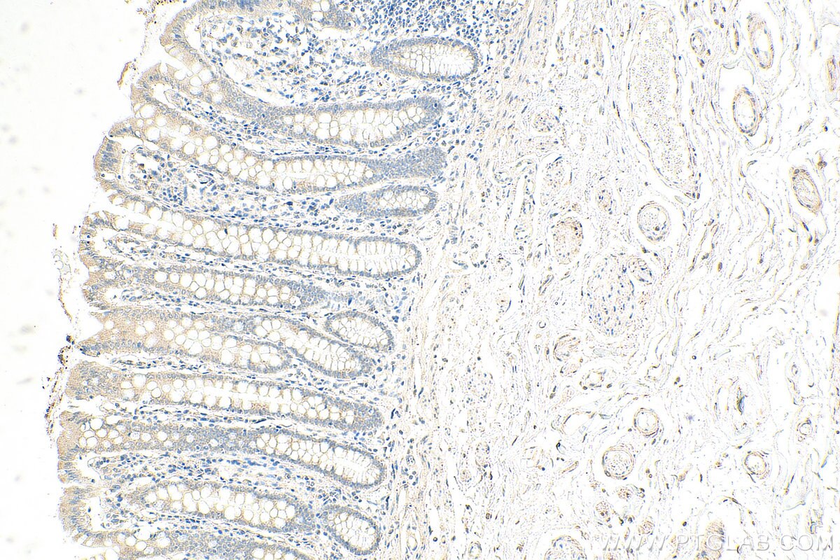 Immunohistochemistry (IHC) staining of human colon tissue using RNF141 Polyclonal antibody (26041-1-AP)