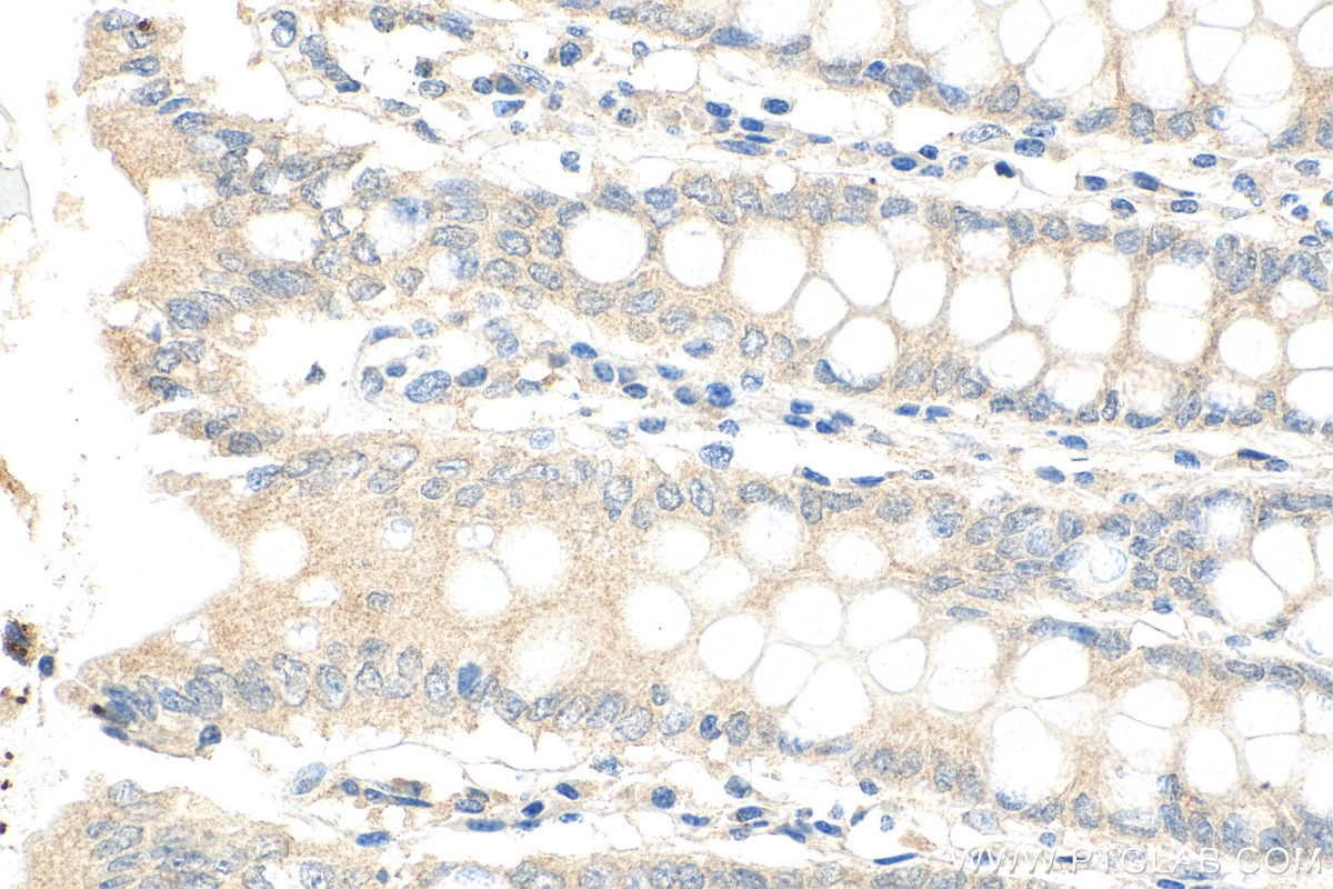 Immunohistochemistry (IHC) staining of human colon tissue using RNF141 Polyclonal antibody (26041-1-AP)