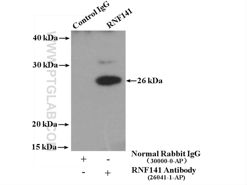 Immunoprecipitation (IP) experiment of mouse testis tissue using RNF141 Polyclonal antibody (26041-1-AP)