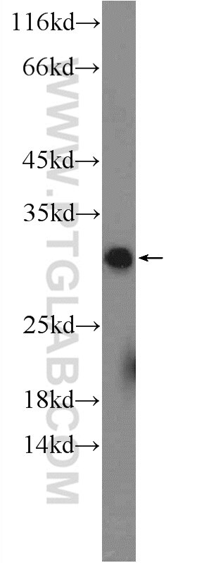 Western Blot (WB) analysis of mouse testis tissue using RNF141 Polyclonal antibody (26041-1-AP)