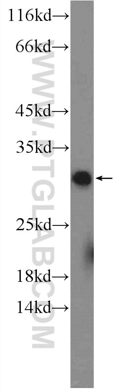 WB analysis of mouse testis using 26041-1-AP