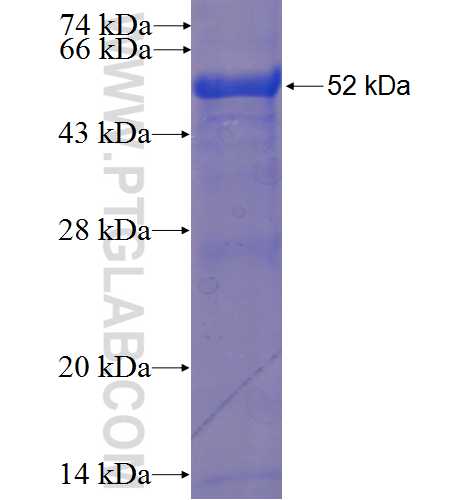 RNF141 fusion protein Ag23316 SDS-PAGE