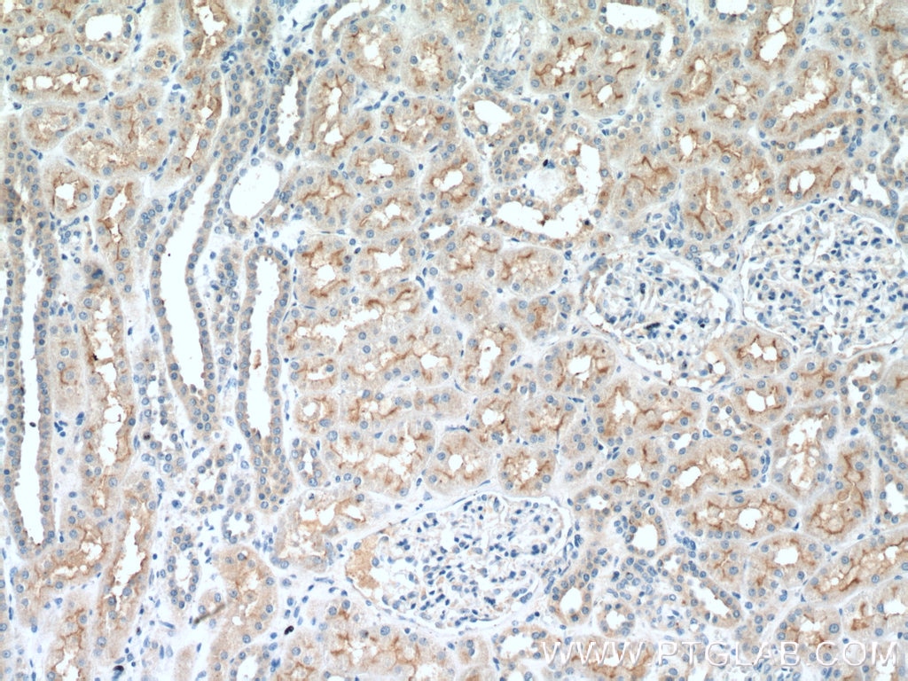 Immunohistochemistry (IHC) staining of human kidney tissue using RNF144B/IBRDC2 Polyclonal antibody (26306-1-AP)