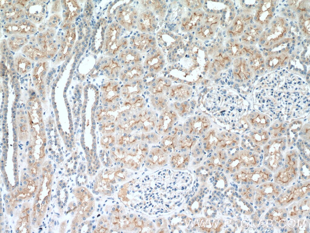 IHC staining of human kidney using 26306-1-AP