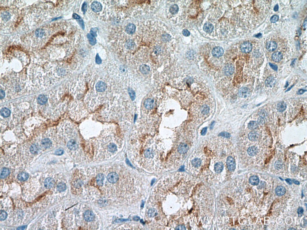 Immunohistochemistry (IHC) staining of human kidney tissue using RNF144B/IBRDC2 Polyclonal antibody (26306-1-AP)