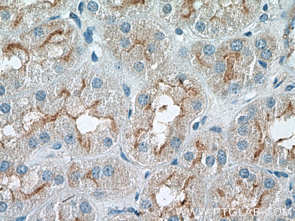 Immunohistochemistry (IHC) staining of human kidney tissue using RNF144B/IBRDC2 Polyclonal antibody (26306-1-AP)