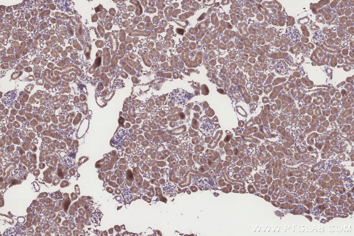 Immunohistochemistry (IHC) staining of mouse kidney tissue using RNF144B/IBRDC2 Polyclonal antibody (26306-1-AP)