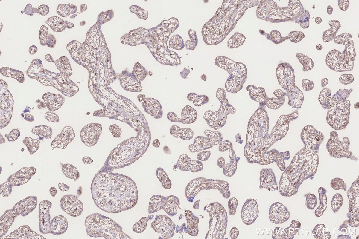 Immunohistochemistry (IHC) staining of human placenta tissue using RNF144B/IBRDC2 Polyclonal antibody (26306-1-AP)