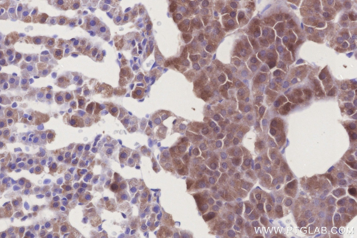 Immunohistochemistry (IHC) staining of rat adrenal gland tissue using RNF144B/IBRDC2 Polyclonal antibody (26306-1-AP)