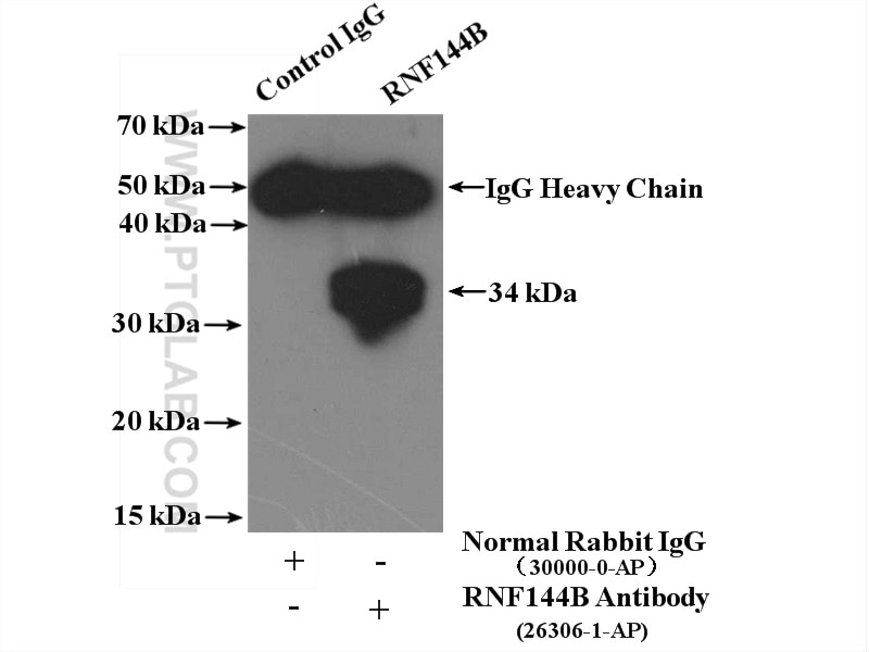 Immunoprecipitation (IP) experiment of HeLa cells using RNF144B/IBRDC2 Polyclonal antibody (26306-1-AP)