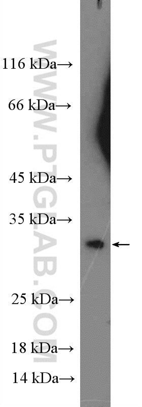 Western Blot (WB) analysis of HeLa cells using RNF144B/IBRDC2 Polyclonal antibody (26306-1-AP)