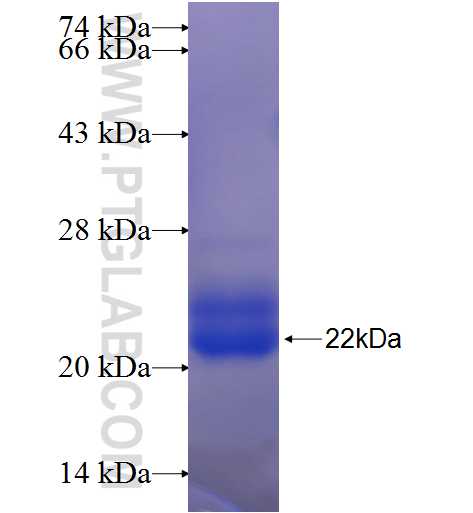 RNF144B fusion protein Ag24635 SDS-PAGE