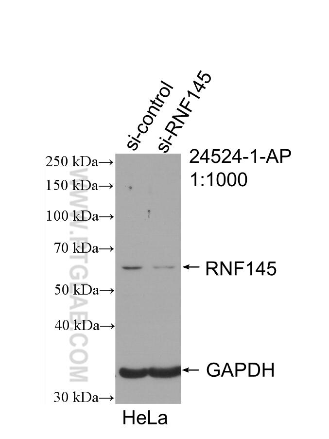 RNF145