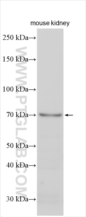 Western Blot (WB) analysis of mouse kidney tissue using RNF145 Polyclonal antibody (24524-1-AP)