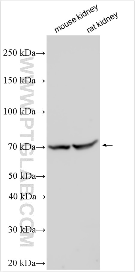Western Blot (WB) analysis of various lysates using RNF145 Polyclonal antibody (24524-1-AP)