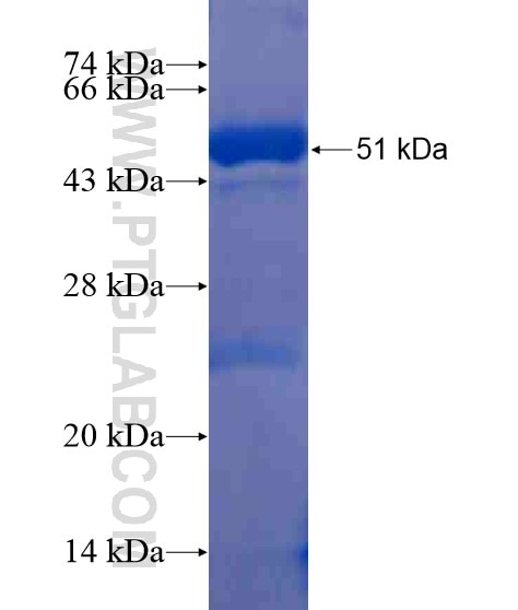 RNF145 fusion protein Ag21463 SDS-PAGE