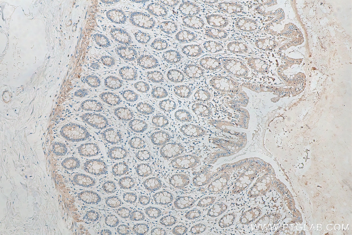 Immunohistochemistry (IHC) staining of human colon tissue using RNF150 Polyclonal antibody (21438-1-AP)