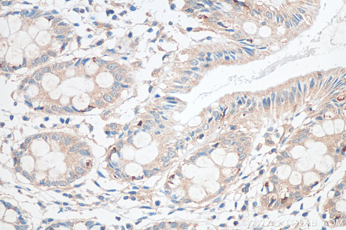 Immunohistochemistry (IHC) staining of human colon tissue using RNF150 Polyclonal antibody (21438-1-AP)