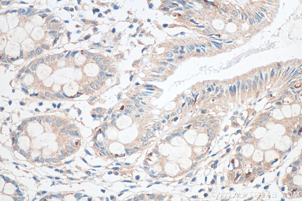 Immunohistochemistry (IHC) staining of human colon tissue using RNF150 Polyclonal antibody (21438-1-AP)