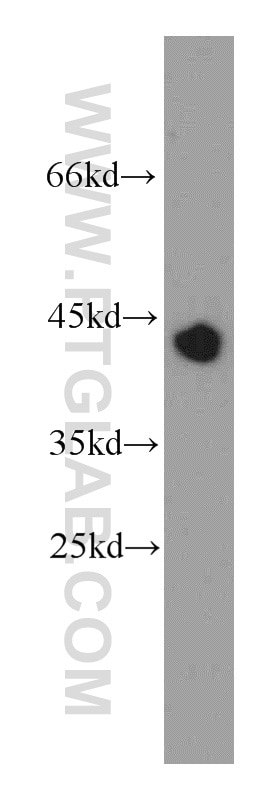 Western Blot (WB) analysis of mouse brain tissue using RNF150 Polyclonal antibody (21438-1-AP)