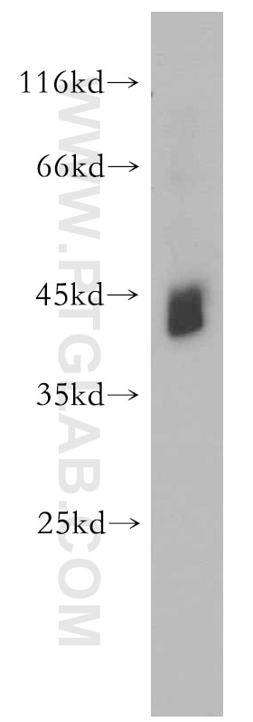 Western Blot (WB) analysis of human heart tissue using RNF150 Polyclonal antibody (21438-1-AP)