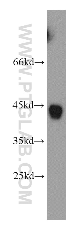 Western Blot (WB) analysis of mouse eye tissue using RNF150 Polyclonal antibody (21438-1-AP)
